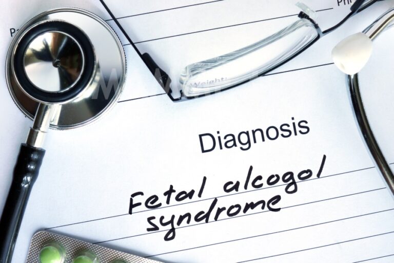 Cos’è la Sindrome alcolica fetale?